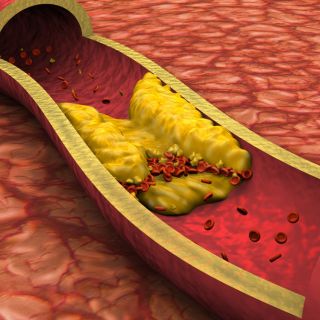 Obniża poziom złego cholesterolu